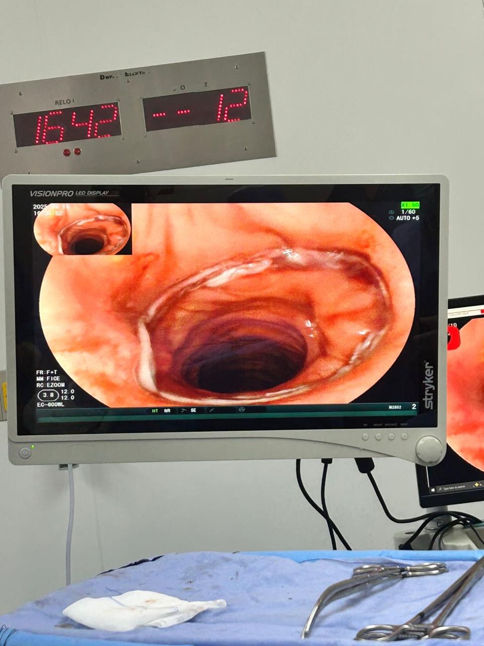 Coloproctólogo en Puebla -Dr. Jorrge Garza Sánchez