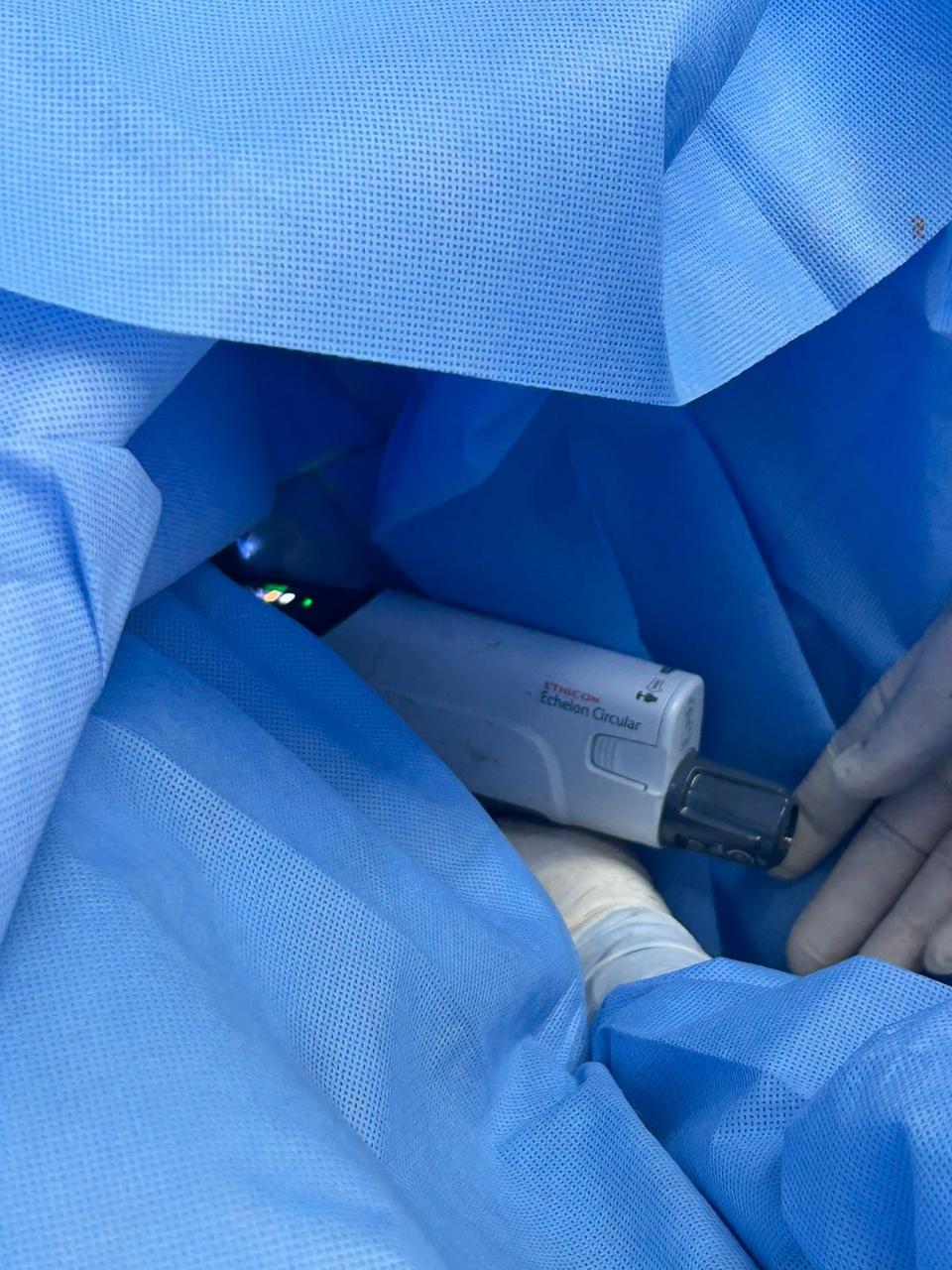 Coloproctólogo en Puebla -Dr. Jorrge Garza Sánchez