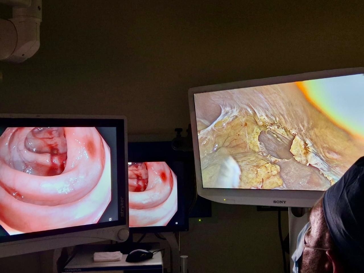 Coloproctólogo en Puebla -Dr. Jorrge Garza Sánchez